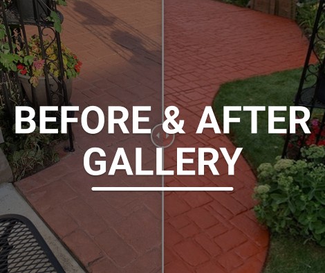 Direct Before and After Gallery